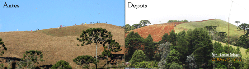 antes-depois-santacasa